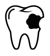 Tooth decay and extraction example